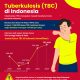 Lonjakan Kasus TBC di Kalbar Lampaui Target WHO, Ini Penjelasan Dokter dan Saran untuk Masyarakat